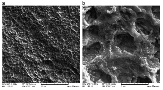 Ruthenium iridium coated anode